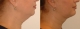 neck-treatments-1