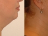 neck-treatments-1