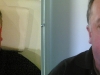 rosacea cosmetic laser clinic Dublin