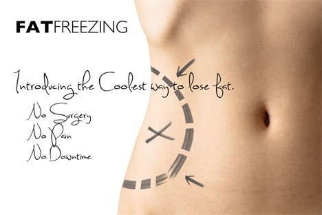 Fat freezing cool lipo treatment dublin castleknock cosmetic clinic