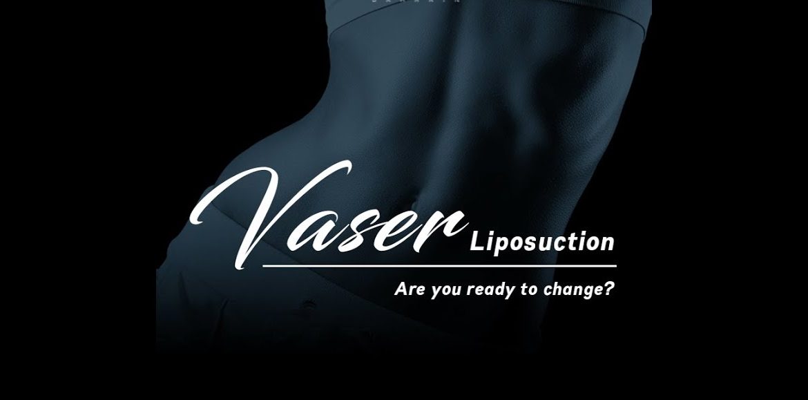 Liposuction with VASER