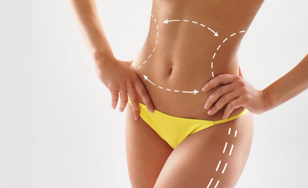 Body sculpting procedures transforming your body shape