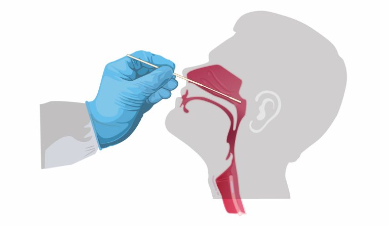 nasal-swab-castleknock-cosmetic-clinic