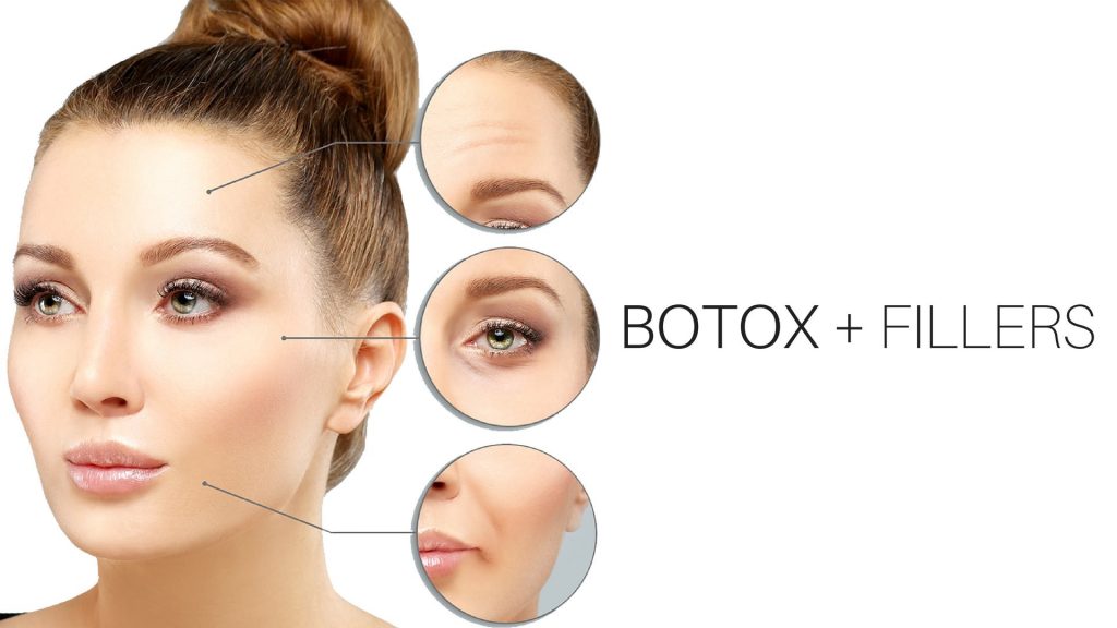 Combination treatment Botox and filler