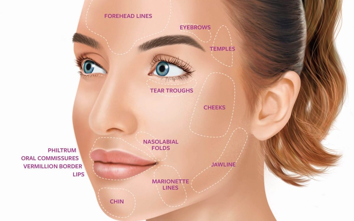 Dermal filler uses Cosmetic Clinic Dublin