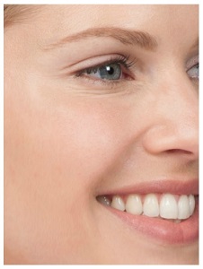 Crows feet after botox injection