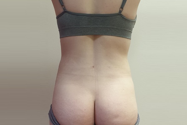 Cinched hourglass waist after