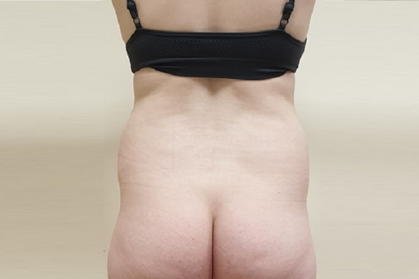 Cinched Hourglass Waist Before