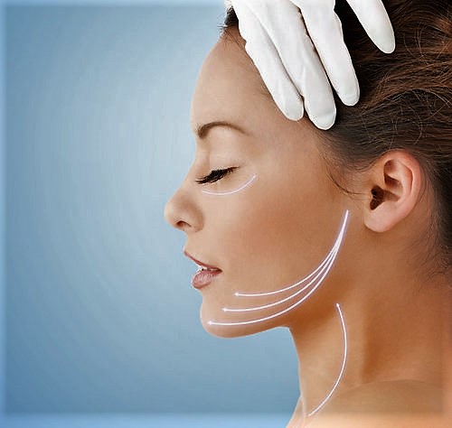 Neferititi-lift-botox-dublin-clinic - Castleknock Cosmetic Clinic