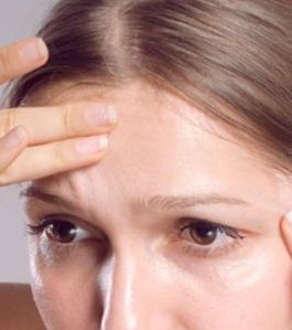 Worry lines botox treatment
