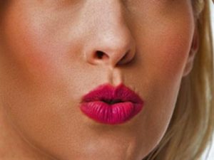 lip lines castleknock clinic dublin dermal fillers smokers lines