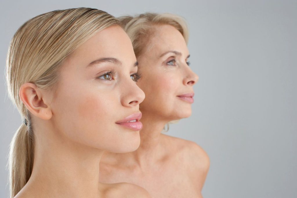 Woman with defined jawline after submental fat and double chin treatment in Dublin