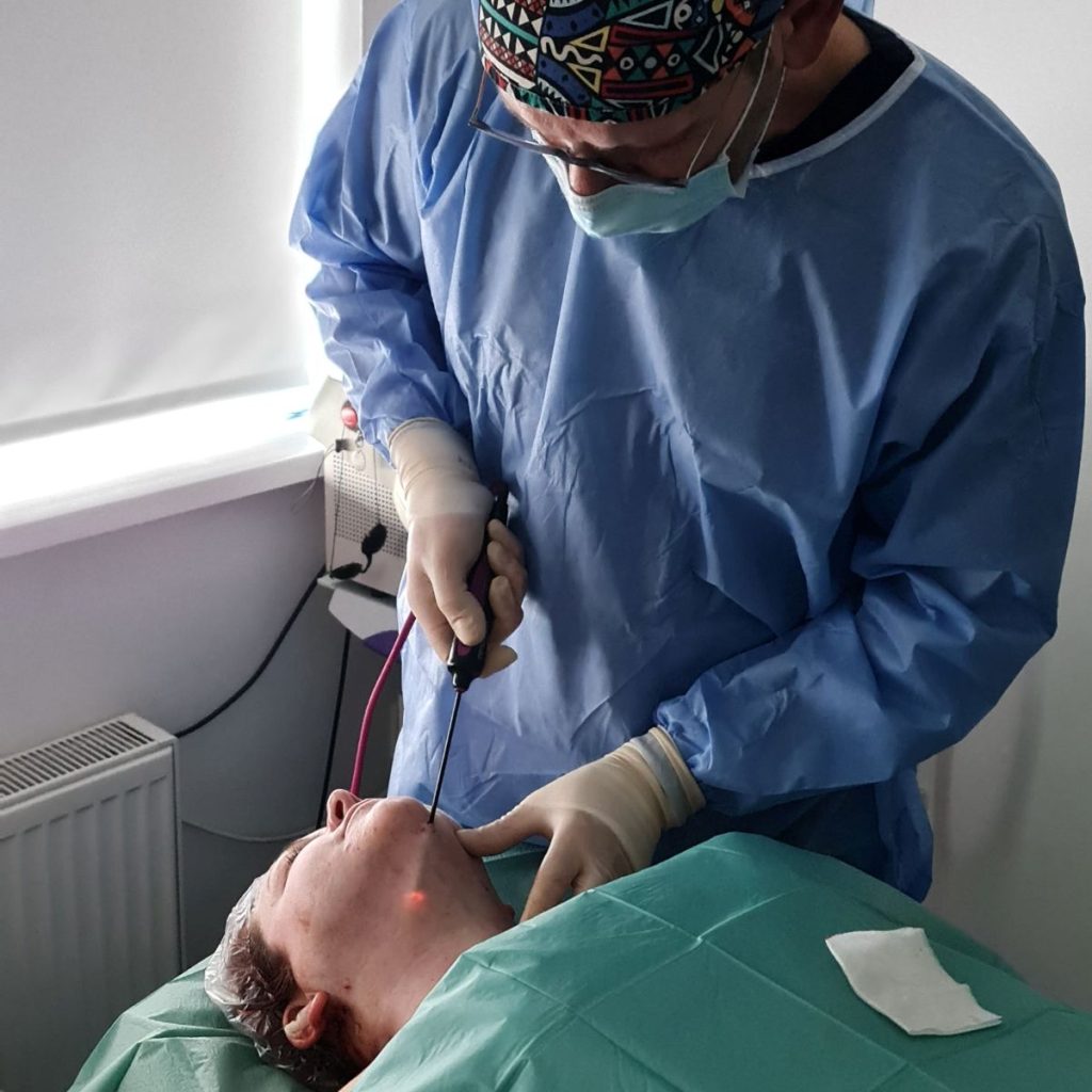 VASER liposuction procedure for double chin and submental fat removal at Castleknock Cosmetic Clinic