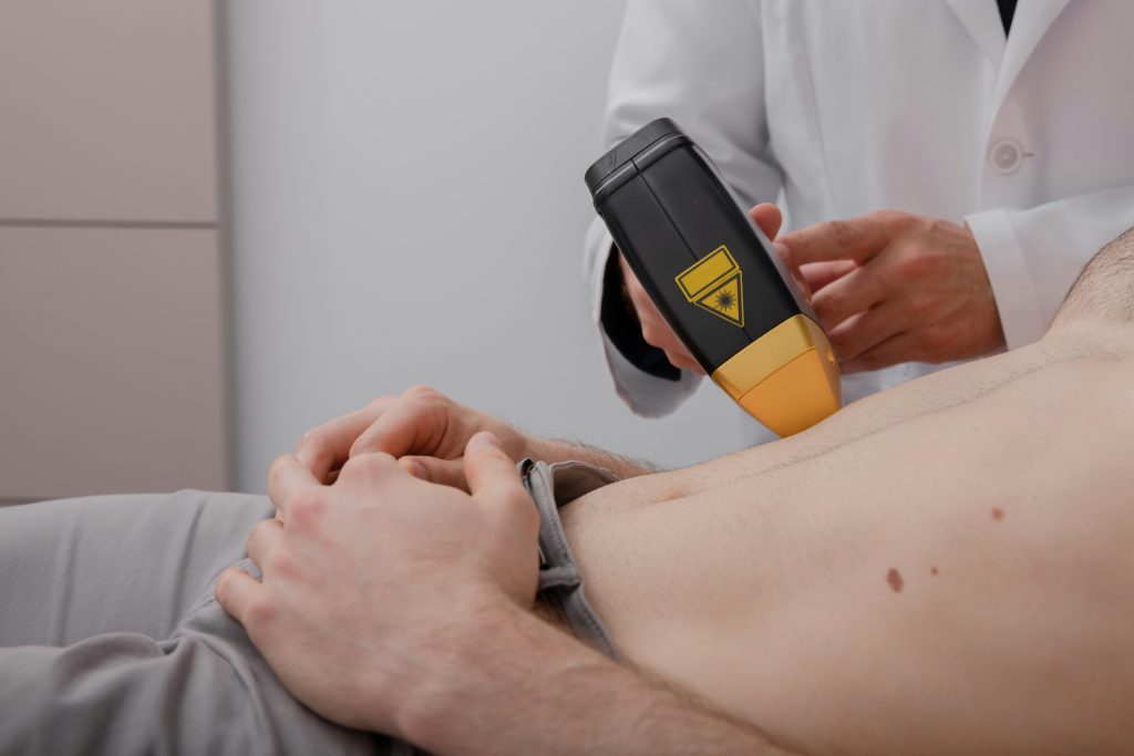 PPP removal Dublin, laser co2 or plasma PPP treatment Dublin Ireland, white bumps on penis, plasma