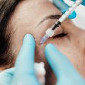 woman getting botox injection crows feet area at dublin cosmetic doctor clinic