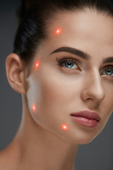Profhilo radiance glow hydration injection dublin cliinic