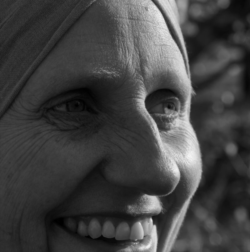 Bunny lines on the nose treatment options