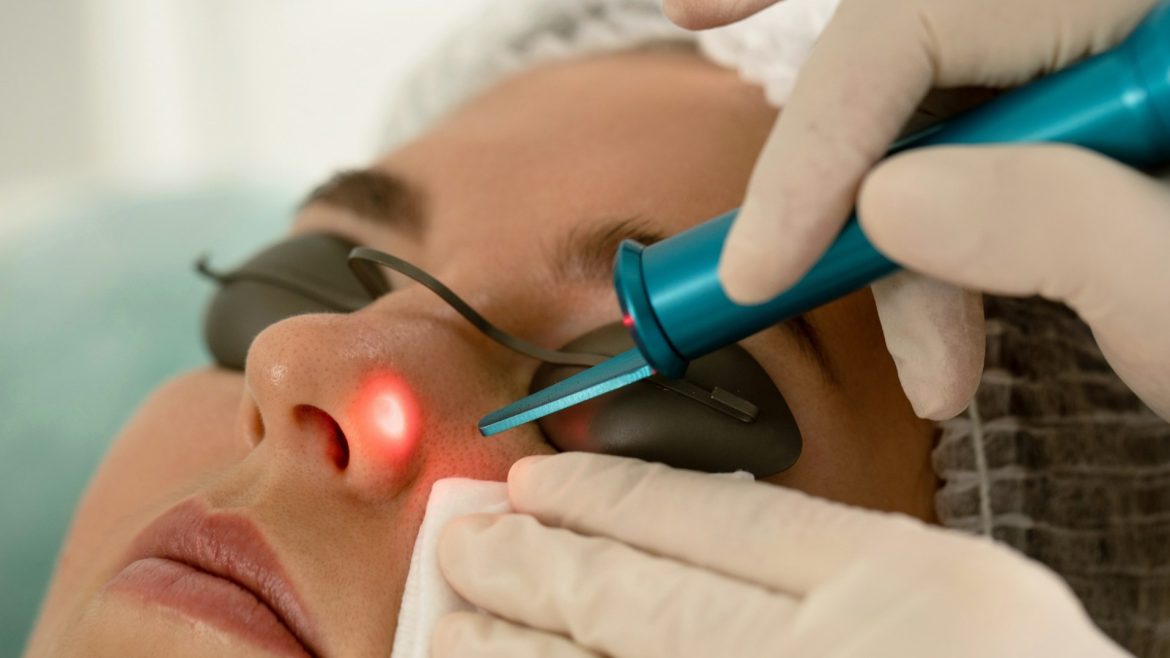 Facial Thread Vein Removal: Laser, IPL and BBL Explained
