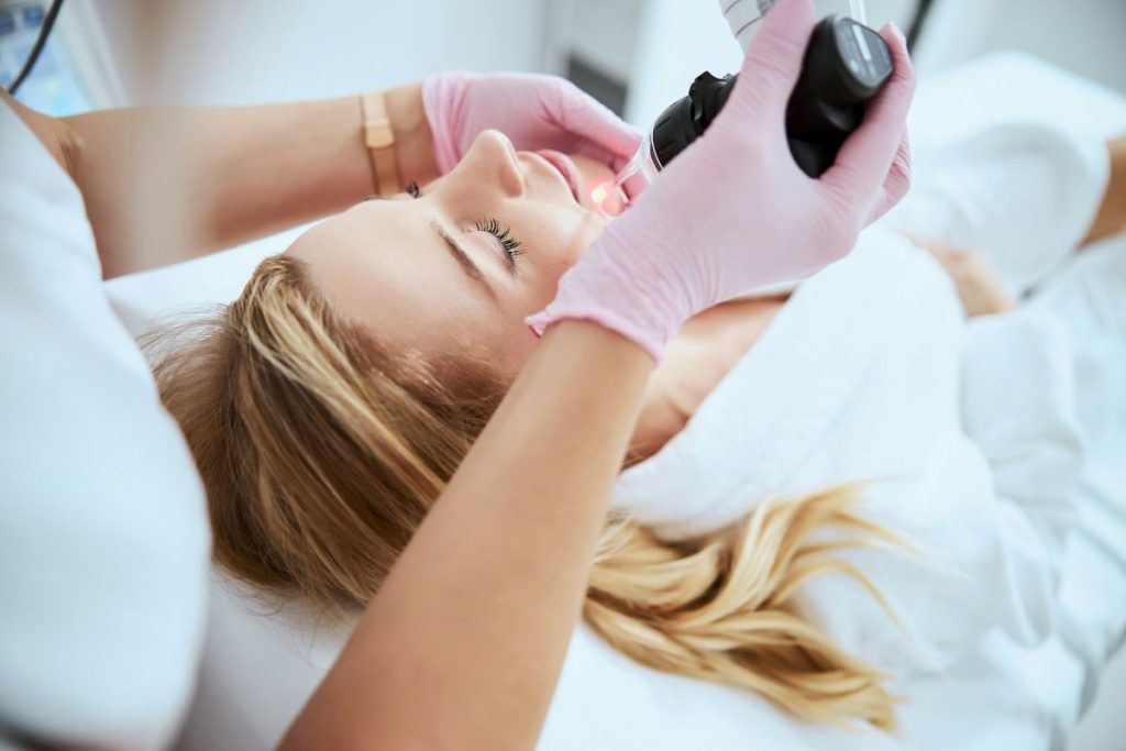 Vascular BBL treatment for facial thread veins at Castleknock Cosmetic Clinic Dublin