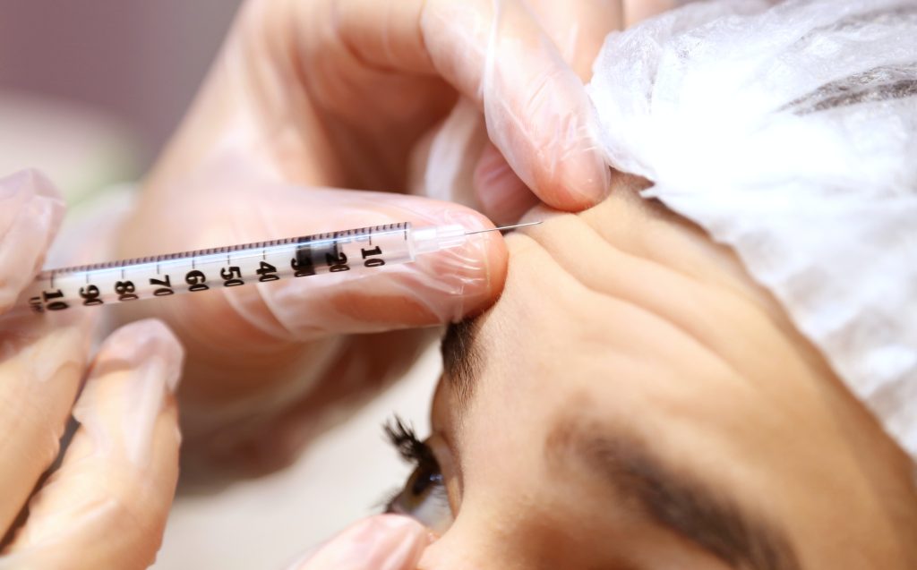 Botox injection for forehead worry lines at Castleknock Cosmetic Clinic Dublin
